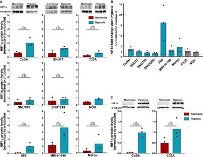 Effects of hypoxia on antigen presentation and T cell-based immune recognition of HPV16-transformed cells
